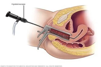 Daignosis-of-Infertility